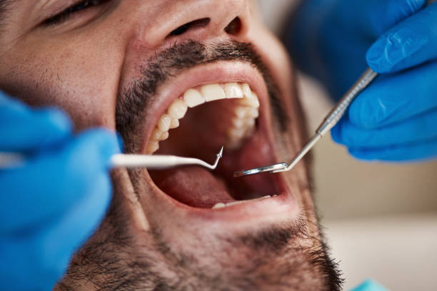 Best Weekend Emergency Dentist in Stone Mountain, GA