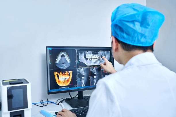 Best Emergency Wisdom Teeth Removal in Stone Mountain, GA
