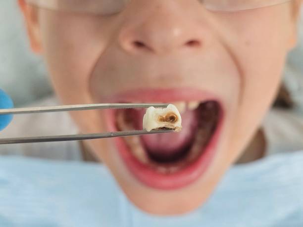 Best Same-Day Emergency Dentist in Stone Mountain, GA